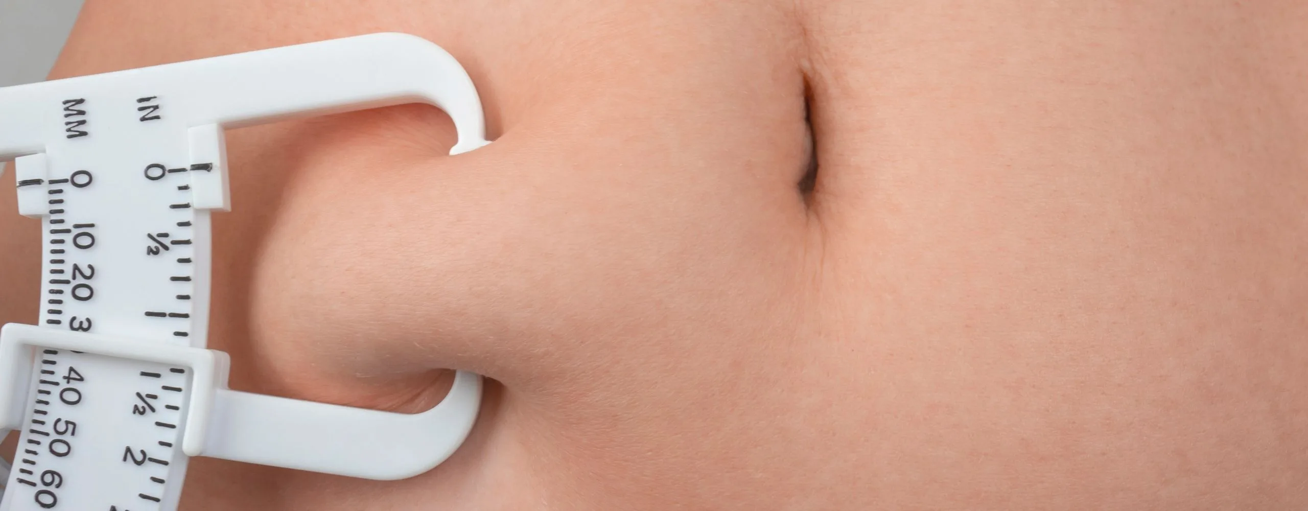 Weight Management